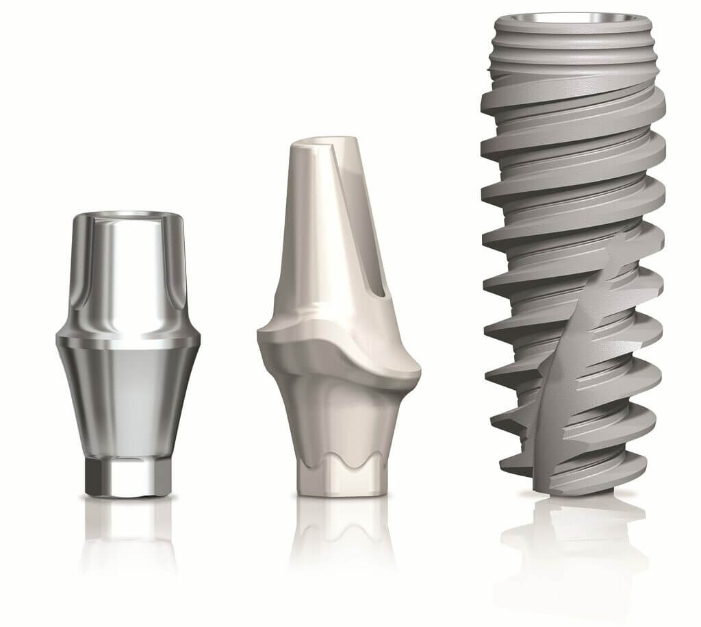 ¿Los implantes se rechazan? 9 Los implantes se rechazan