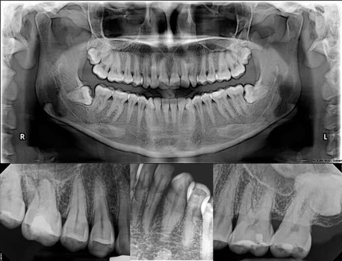 Clinica Dental ME Barcelona Ciruigia Oral 1