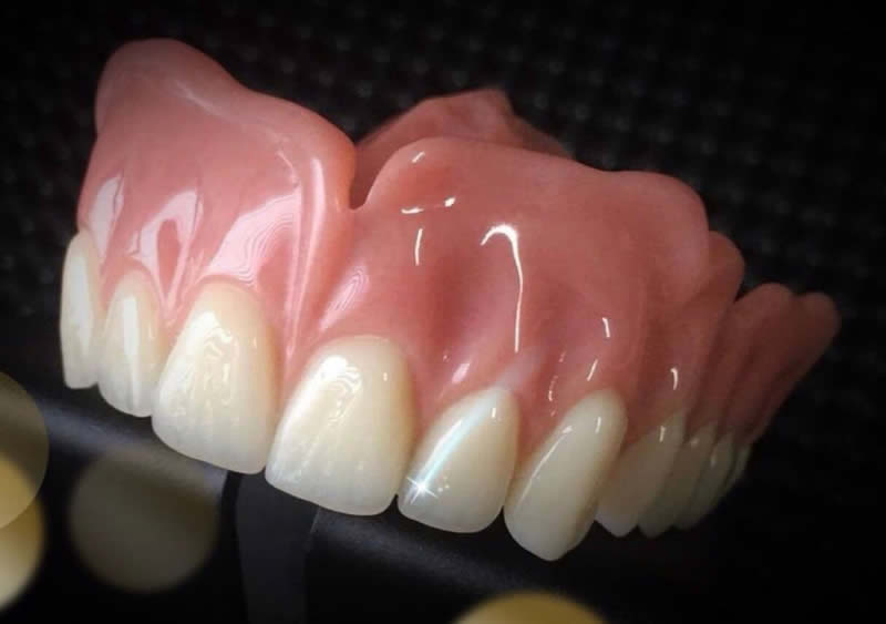 Clinica Dental ME Barcelona - Protesis Completas
