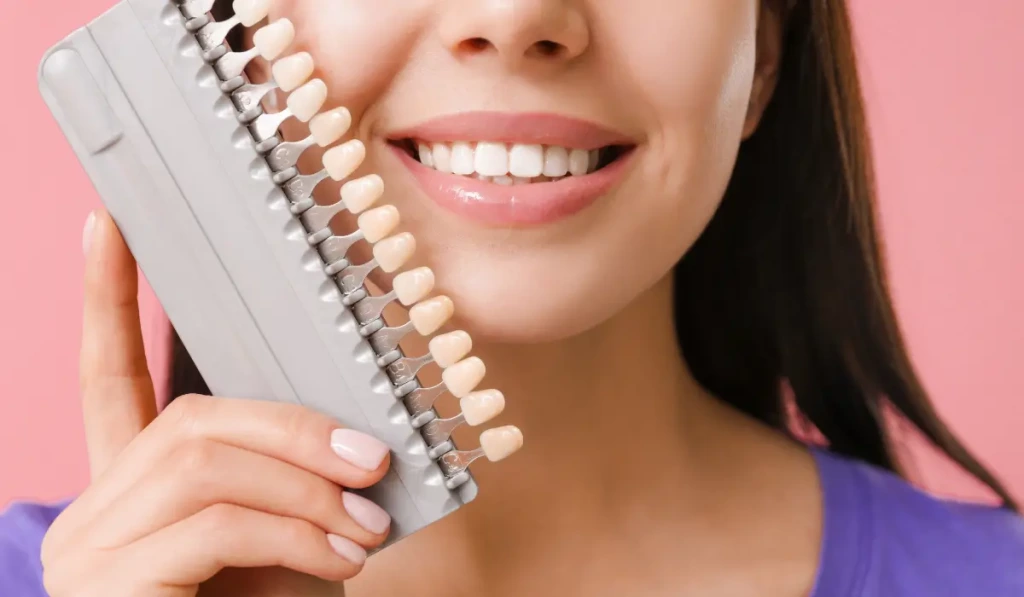 Carillas dentales en Barcelona precio Clinica Mireia Espinosa