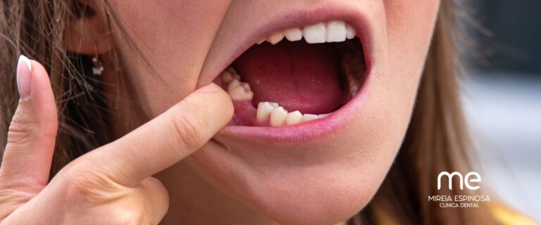 Inicio 13 Diente que sale de la boca