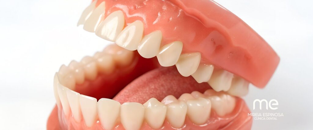 Protesis Dental en Clinica Mireia Espinosa Barcelona