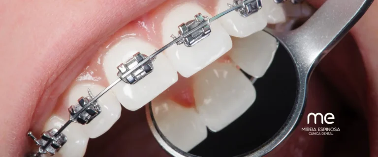 Inicio 11 Clinica dental Mireia Espinosa funciones de la ortodoncia