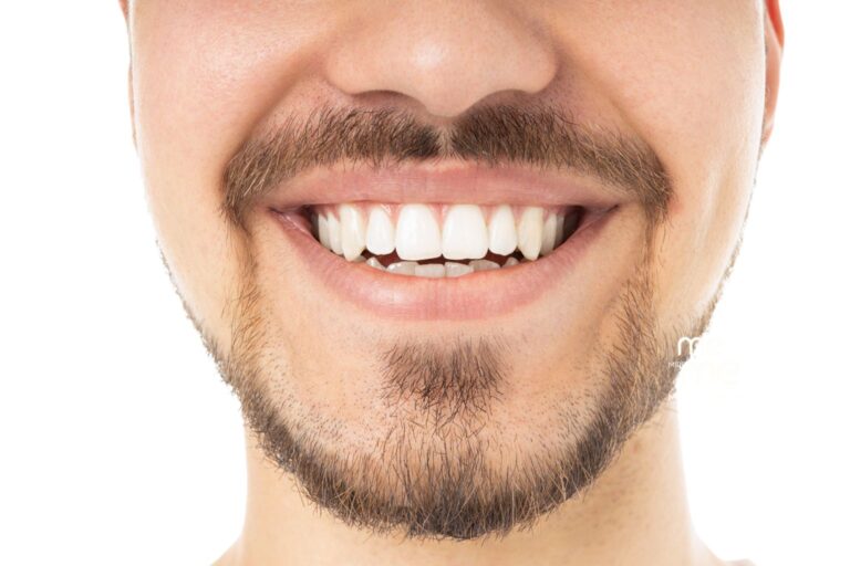 Blanqueamiento Dental Clínica Mireia Espinosa en Barcelona