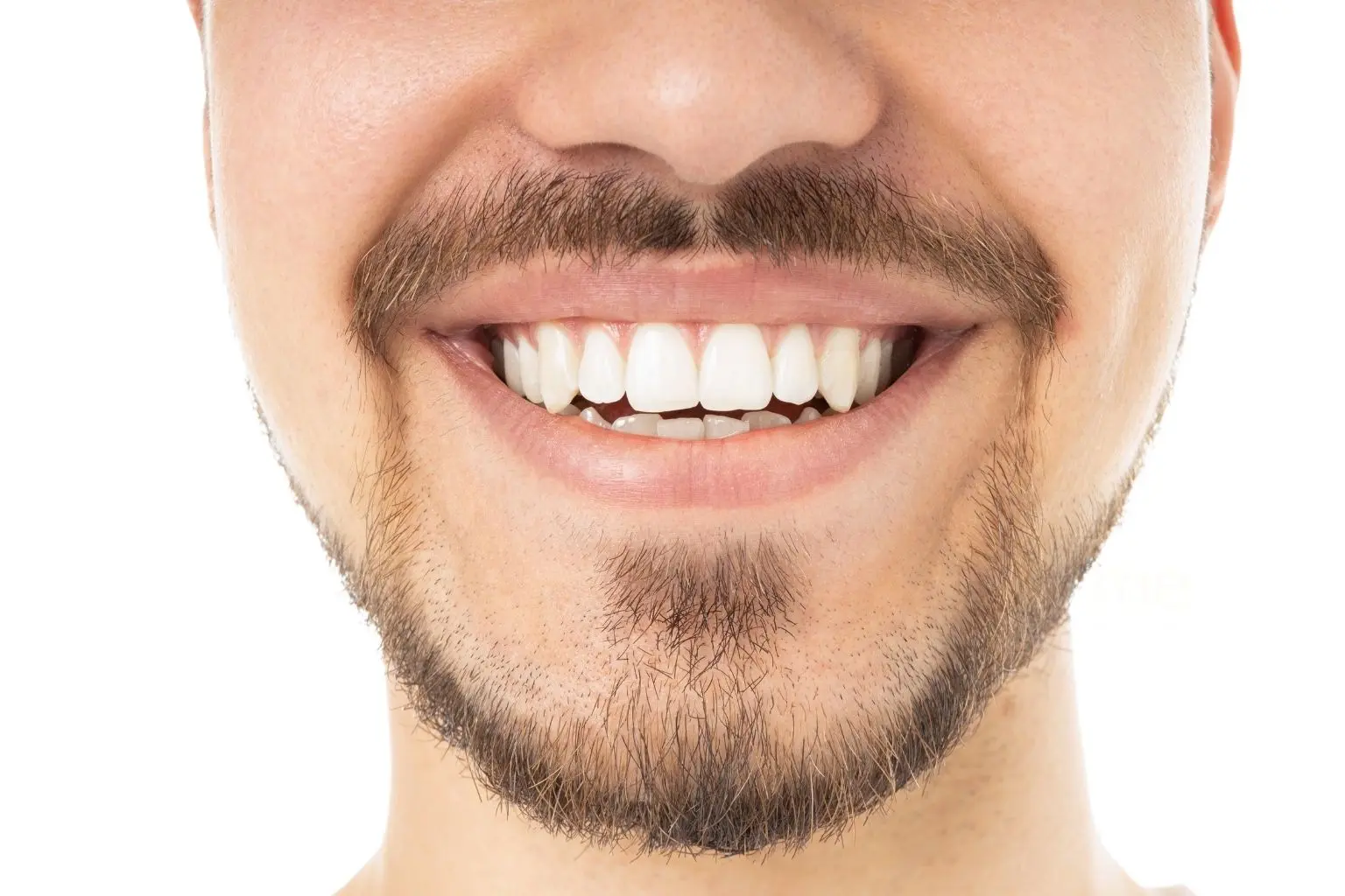 Blanqueamiento dental en Barcelona Clinica Mireia Espinosa