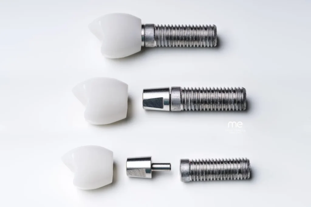 Implante dental en Barcelona (Eixample Esquerra) Clinica Dental Mireia Espinosa