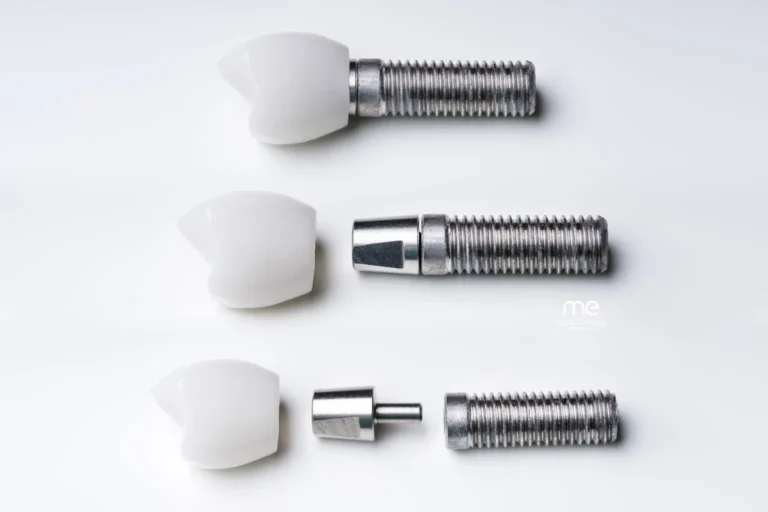 Implante dental en Barcelona (Eixample Esquerra) Clinica Dental Mireia Espinosa