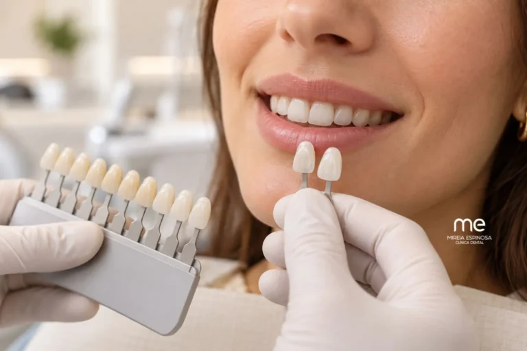 Inicio 74 Comparación de carillas de composite y porcelana para una sonrisa natural
