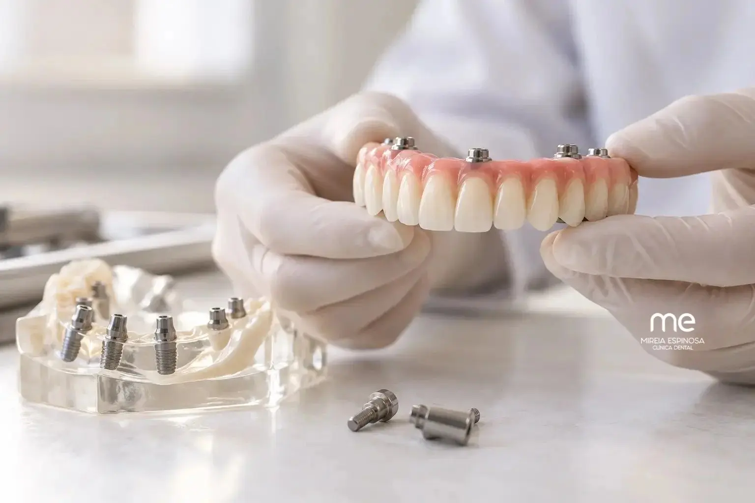 Dientes fijos en 1 día Clinica Mireia Espinosa en Barcelona